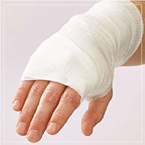 hand in temperory cast